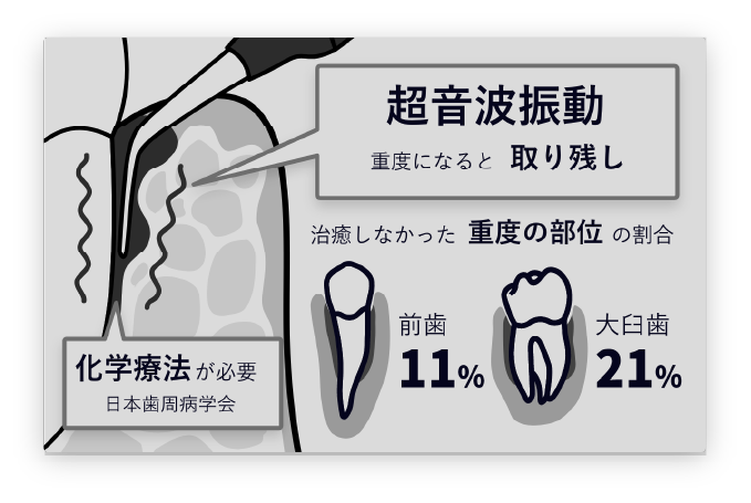 従来の歯周病治療