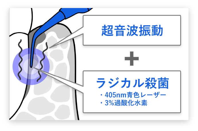 ブルーラジカル