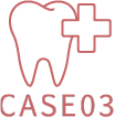 case03