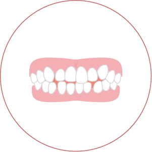 八重歯