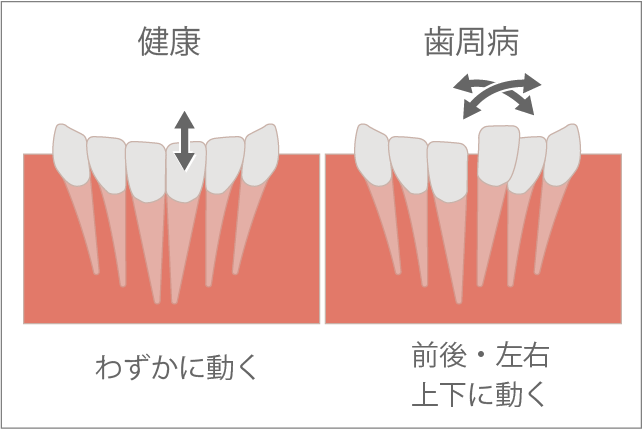 動揺度検査の模式図