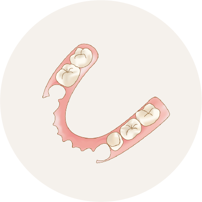 ノンクラスプデンチャー