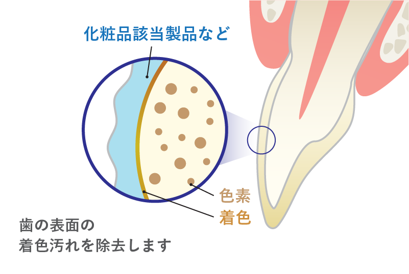 歯肉(歯ぐき)検査の様子